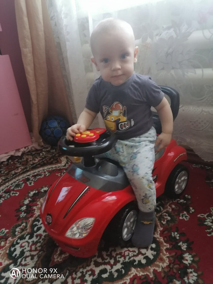 Сильные мешки под глазами,