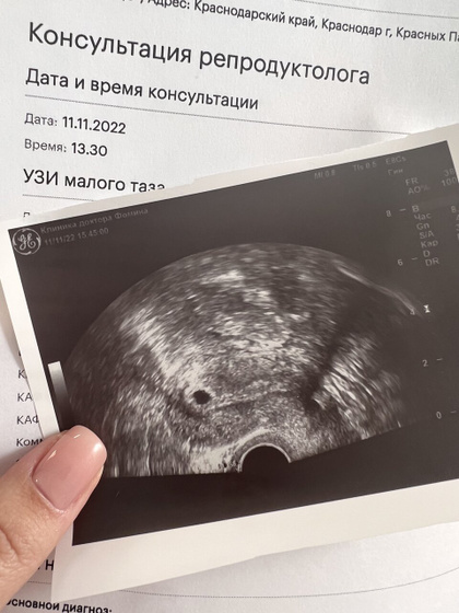 Воть! Плодное яйцо?