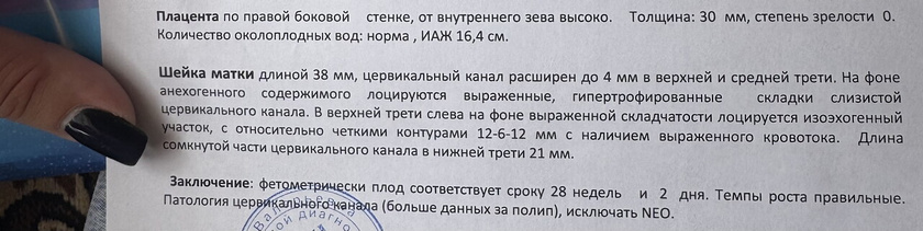 Девочки привет, была на