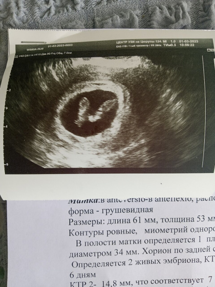 Приветик всем.