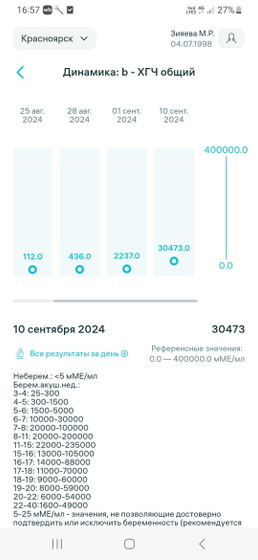 Хгч