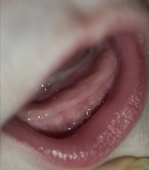 Зубы