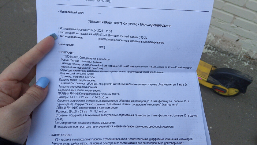 Задержка