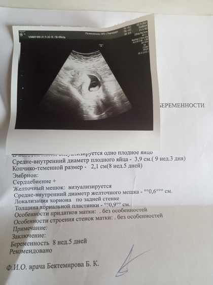Вторая беременность