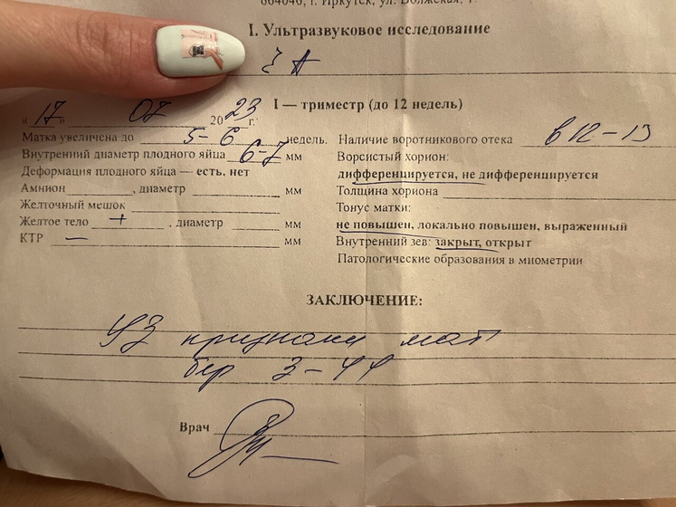 КРИК ДУШИ🆘 4-5 недель