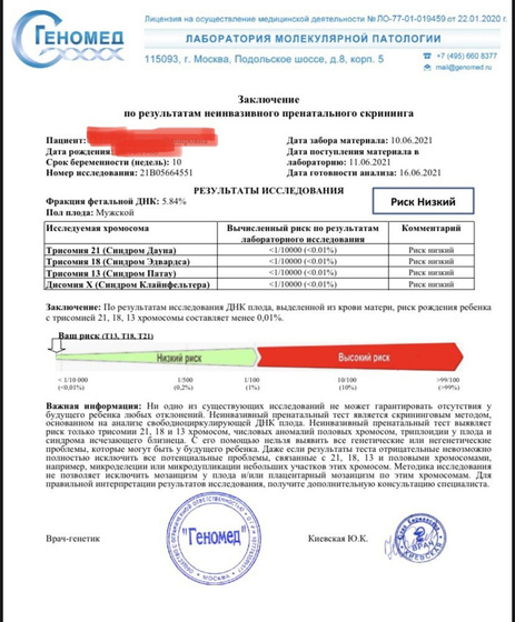 Биопсия ворсин хориона