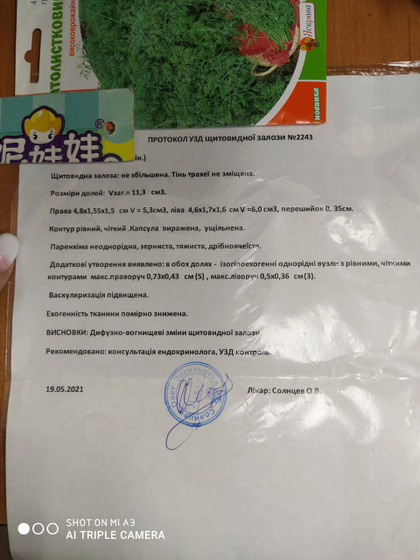 УЗИ щитовидной железы