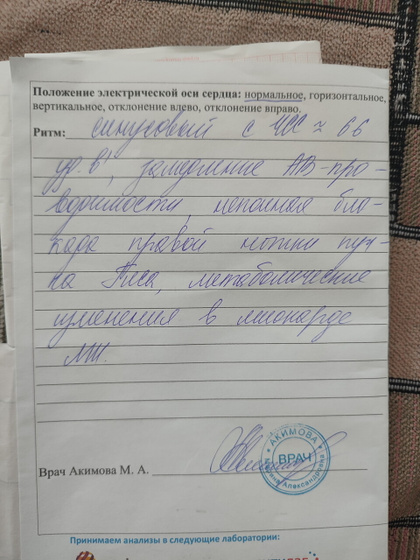 Экг