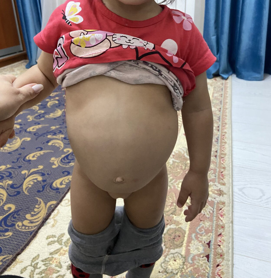 Большой живот