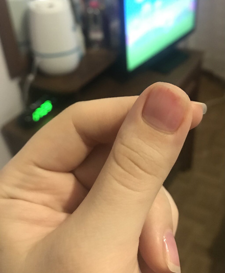 Девочки что с ногтем?