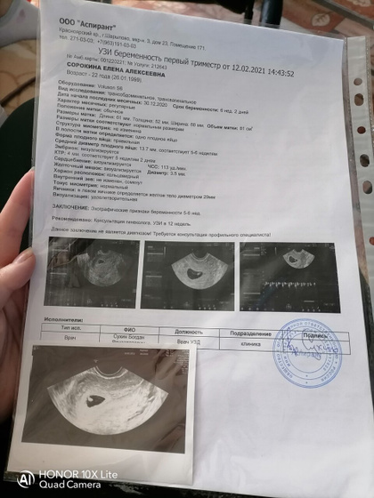 Сделала узи? по сроку