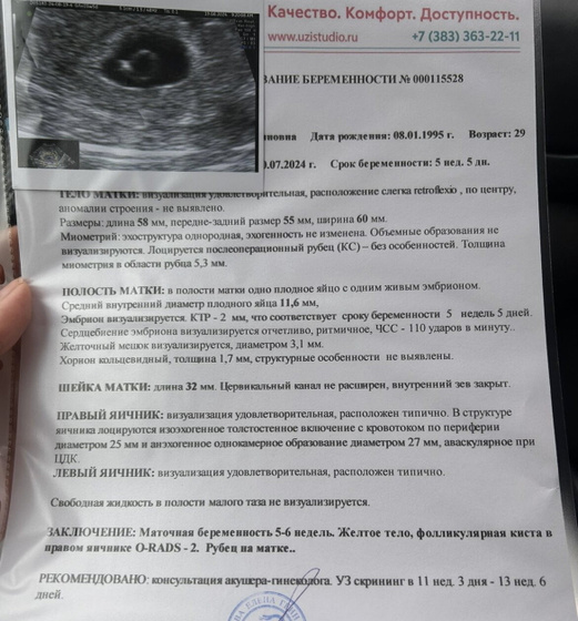 Третья беременность с резус-конфликтом