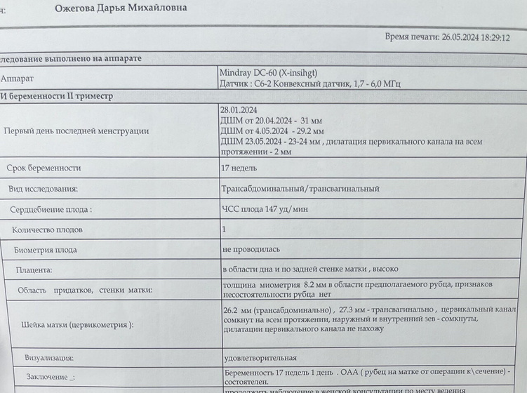 Сходила еле раз на узи