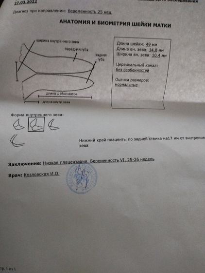 Девочки срок 25-26 недель.