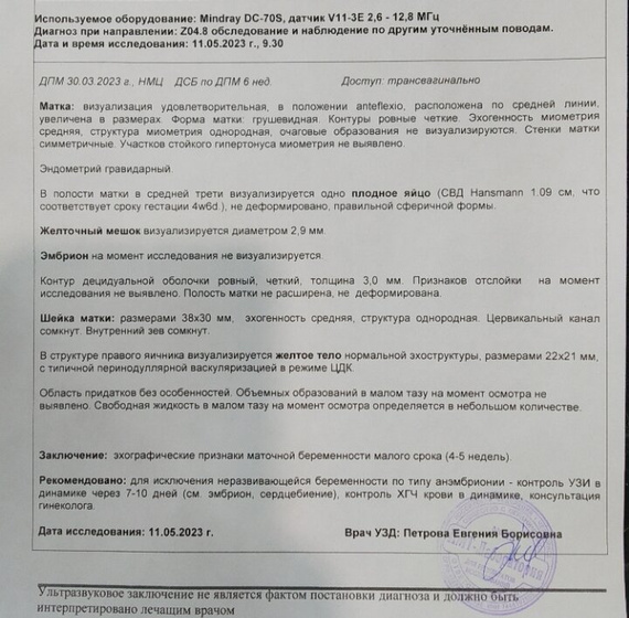 УЗИ