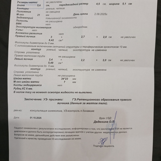 Узи