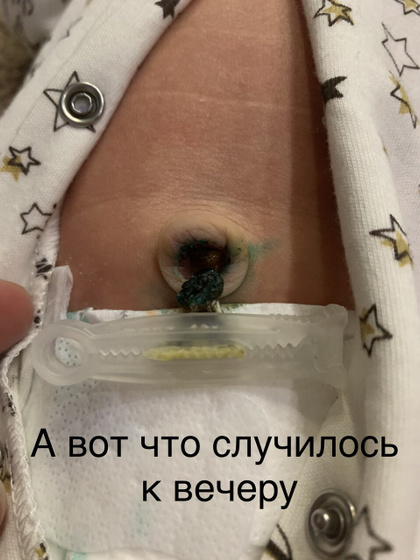 Пупок