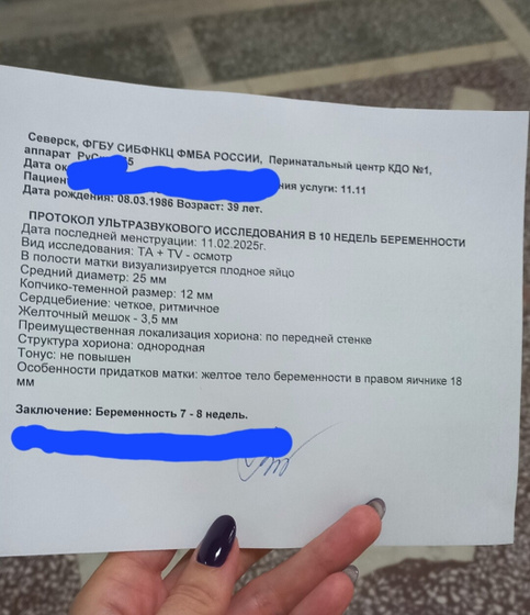 Узи