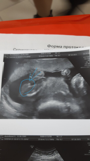 Ну вот и интрига