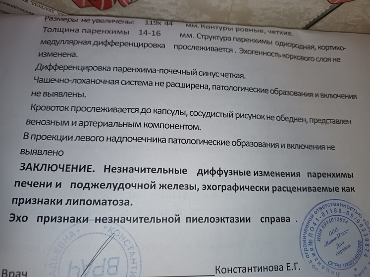 Липоматоз и расширение лоханки