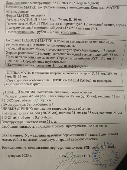 Узи