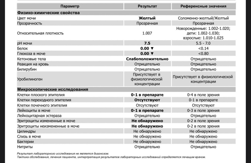 Общий анализ мочи