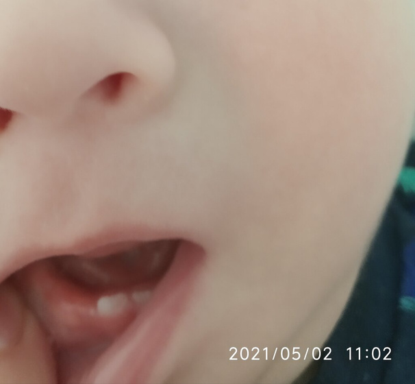 Это нижние резцы прорезаются