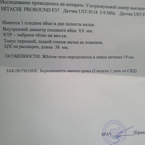 Узистка сказала что что-то