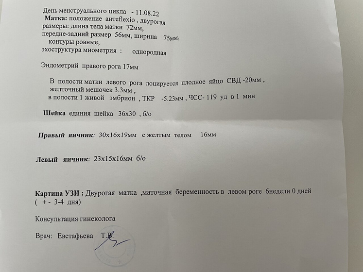 Снова УЗИ Господи я