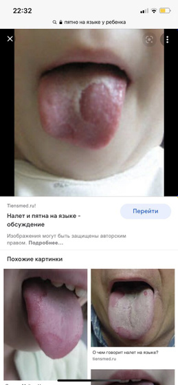 Пятно на языке
