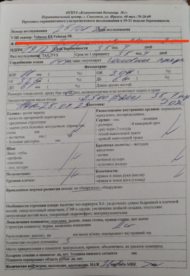 Сходила на КТГ и