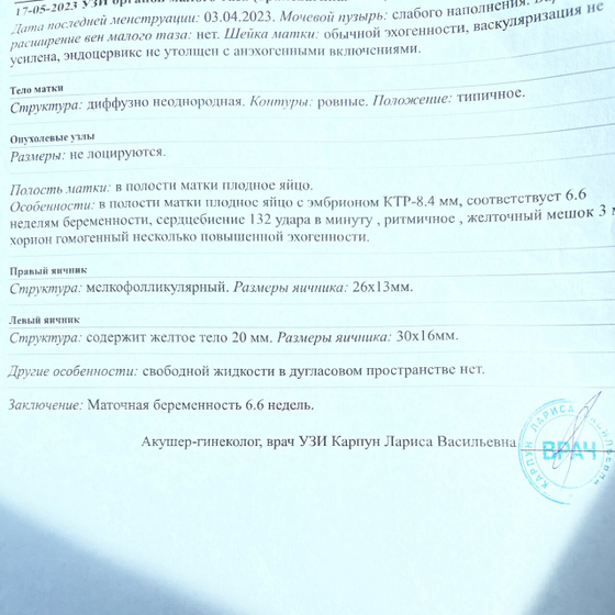 Вот узи.