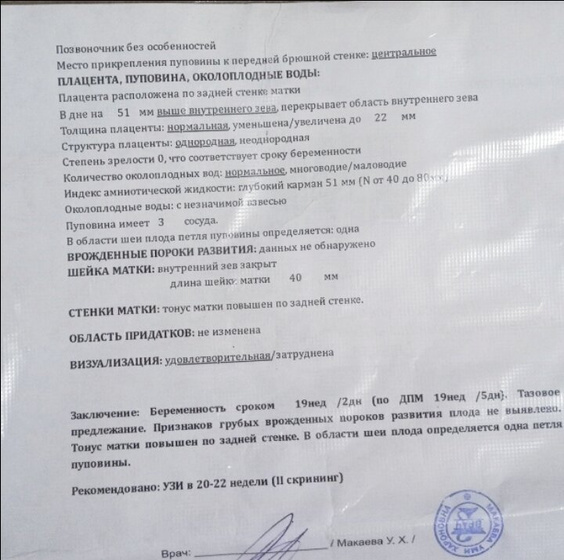 Девочки, ИАЖ 51мм на