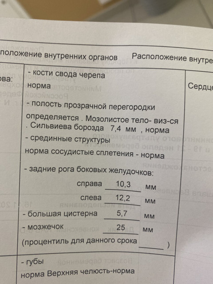 Вентригуломегалия