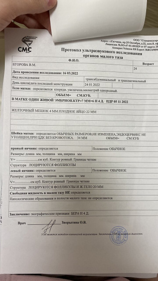 Узи