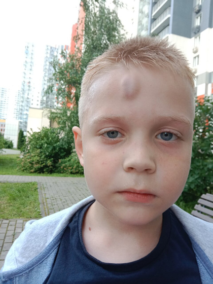 Ребенок ударился на площадке.