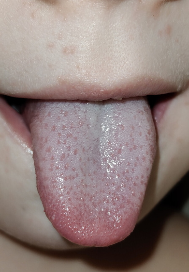 .