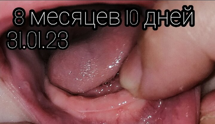 Первый наш зуб