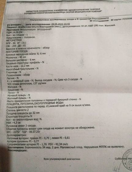 Узи.