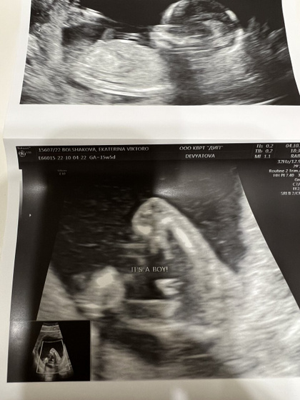 It’s a boy