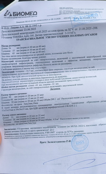На узи пока пусто?