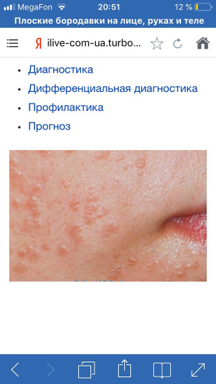 На лице появились вот