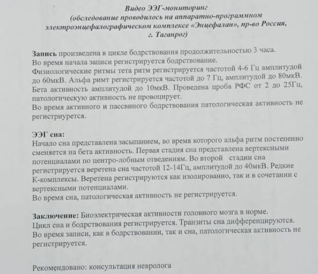 ЭЭГ