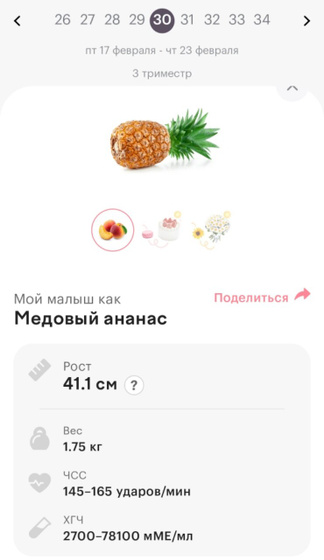 30 недель, дождалась🙏 Диагноз