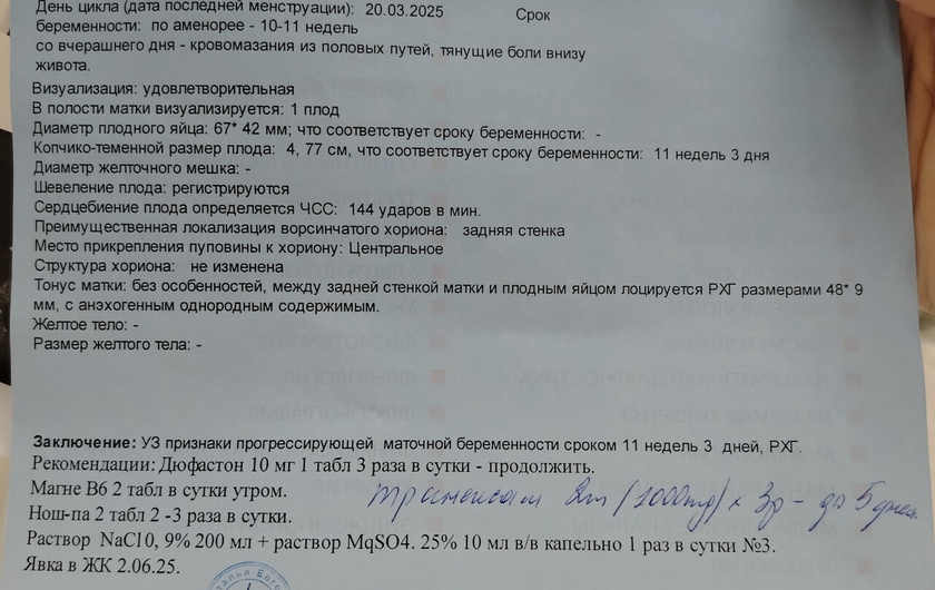 Сходила к врачу на приём, сделали узи.
