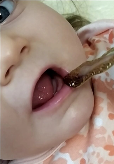 У нас вылезли месяц
