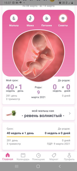 Симфизит, сужение таза, крупный плод. КС.