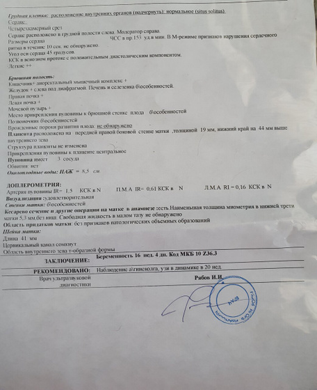 Ходила на узи,чтобы посмотреть пол. Срок 16+4