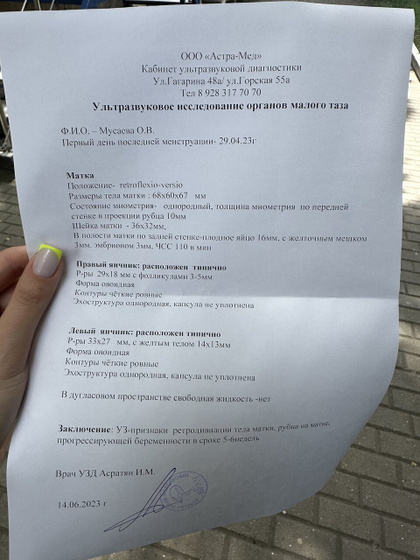 Узи