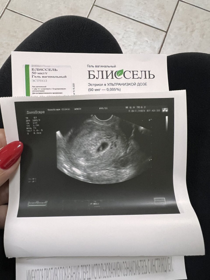 27дпп